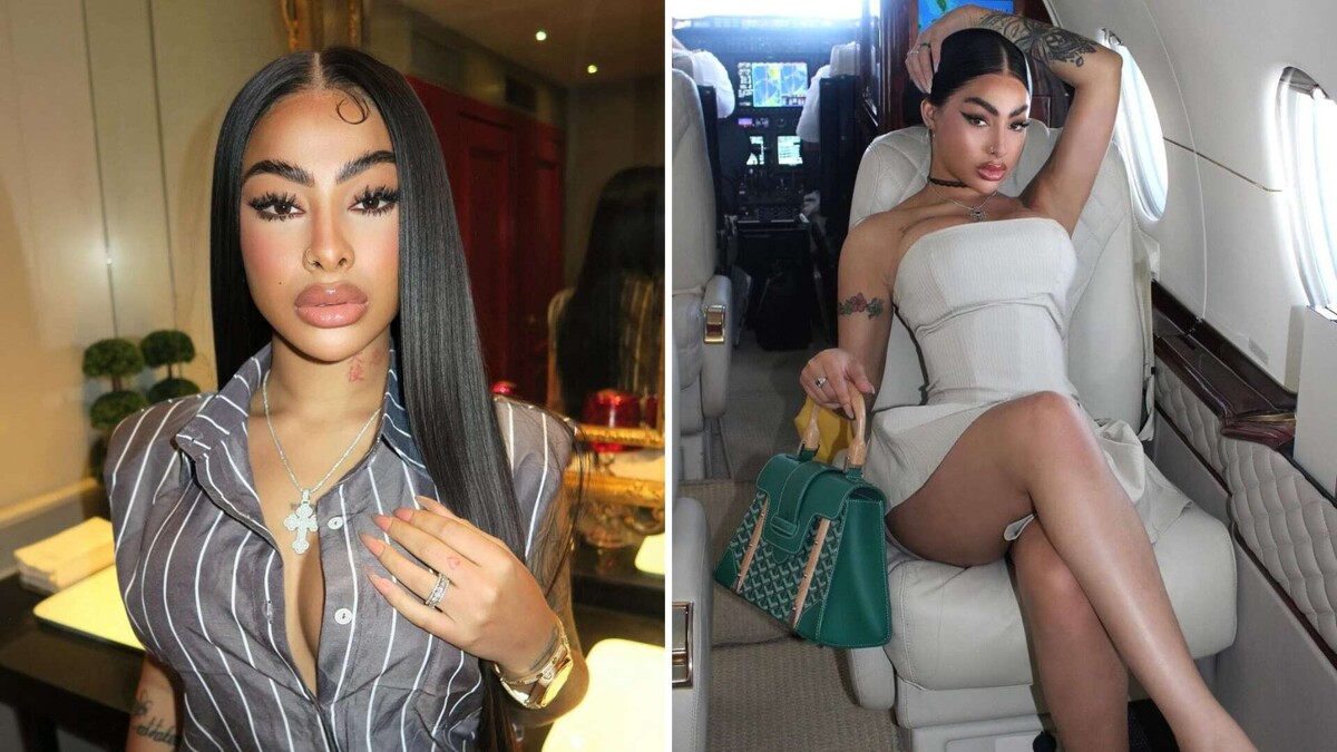 Яйлин, самая вирусная, сталкивается с рисками для здоровья после операции